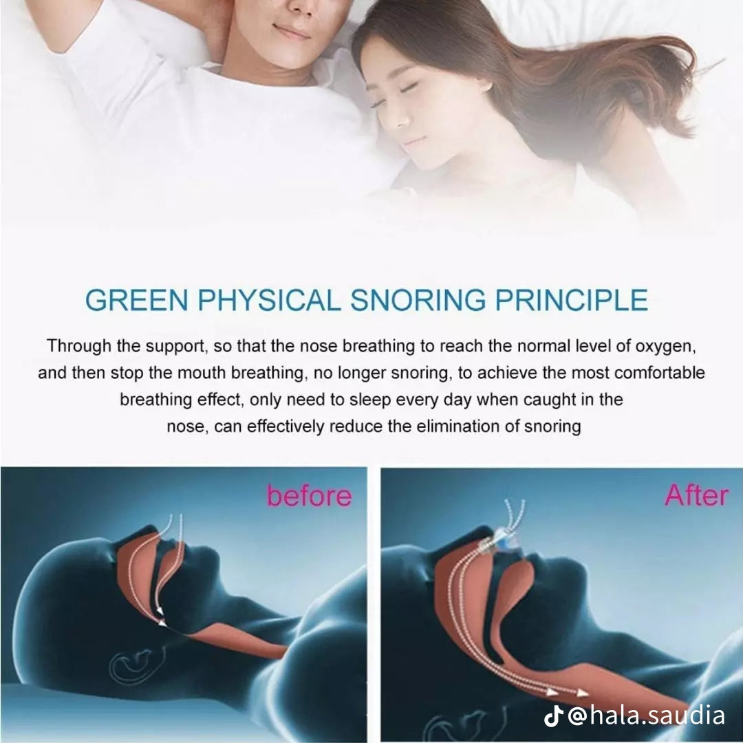 Appareil Anti snoring