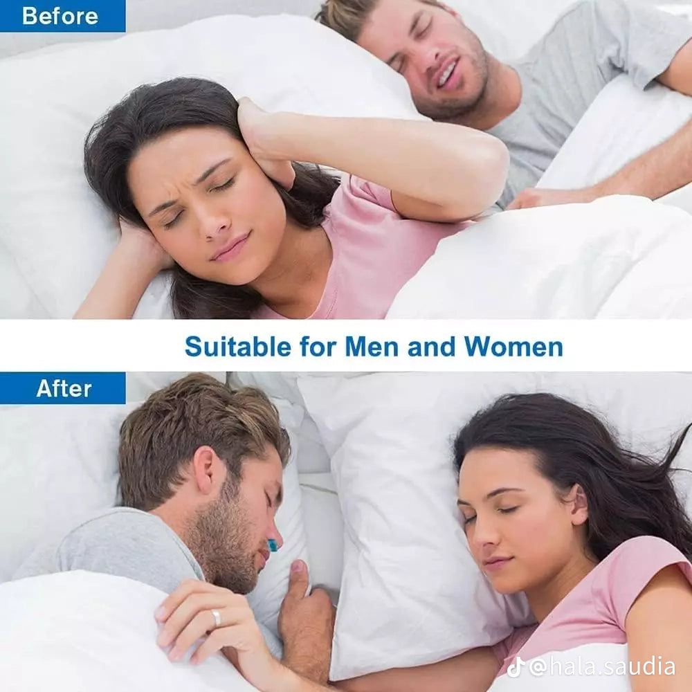 Appareil Anti snoring